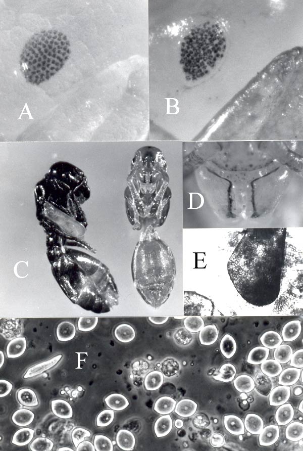 Gregarinen Mattesia.jpg