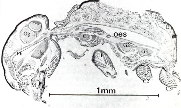 Thorakaler Kropf 2.jpg
