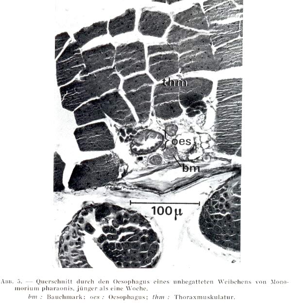 Thorakaler Kropf 5.jpg