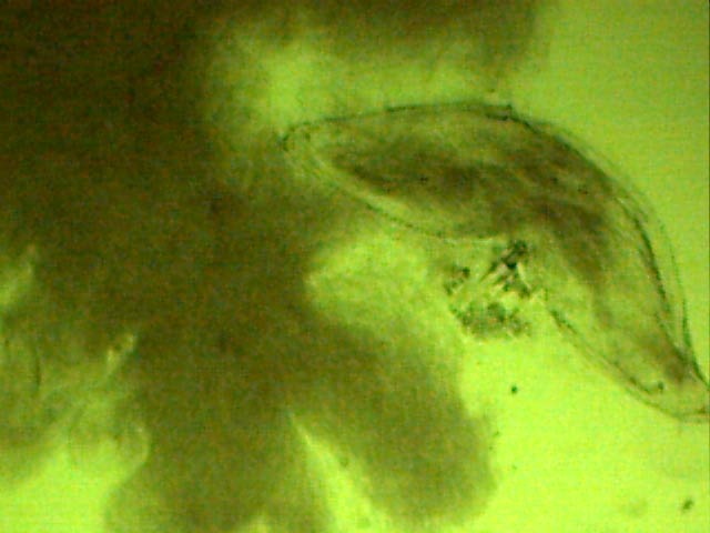 06 Pd Gyne 3-06 Rec - Sperma web.jpg