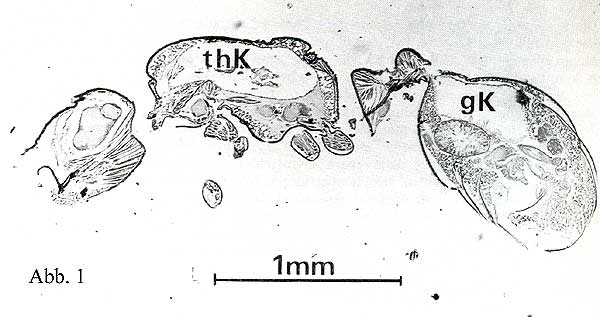 Thorakaler Kropf 1.jpg